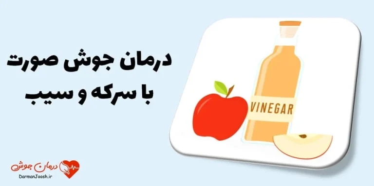 کاهش سریع التهاب جوش صورت با ۷ روش خاص!