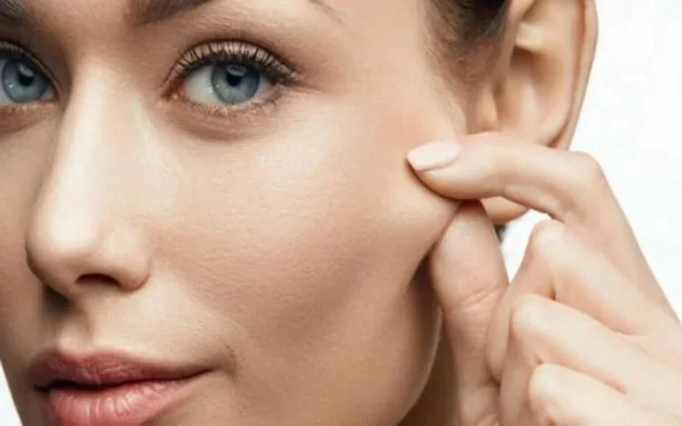 چرا پوست صورت افتاده می شود