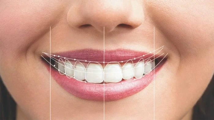 Orthodontics in pregnancy