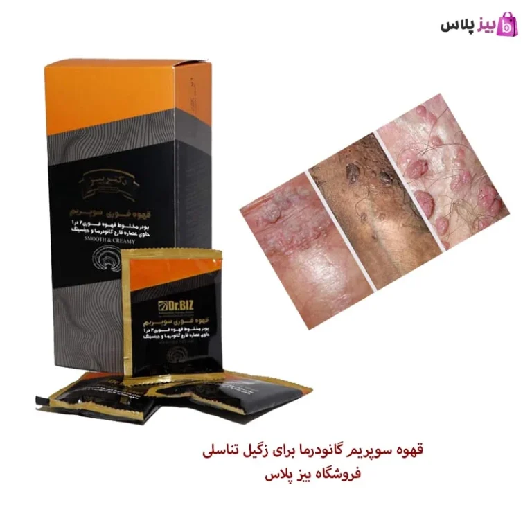 بهترین درمان برای زگیل تناسلی چیست