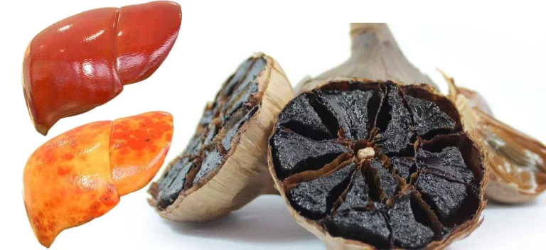 طریقه مصرف سیر سیاه برای کبد چرب