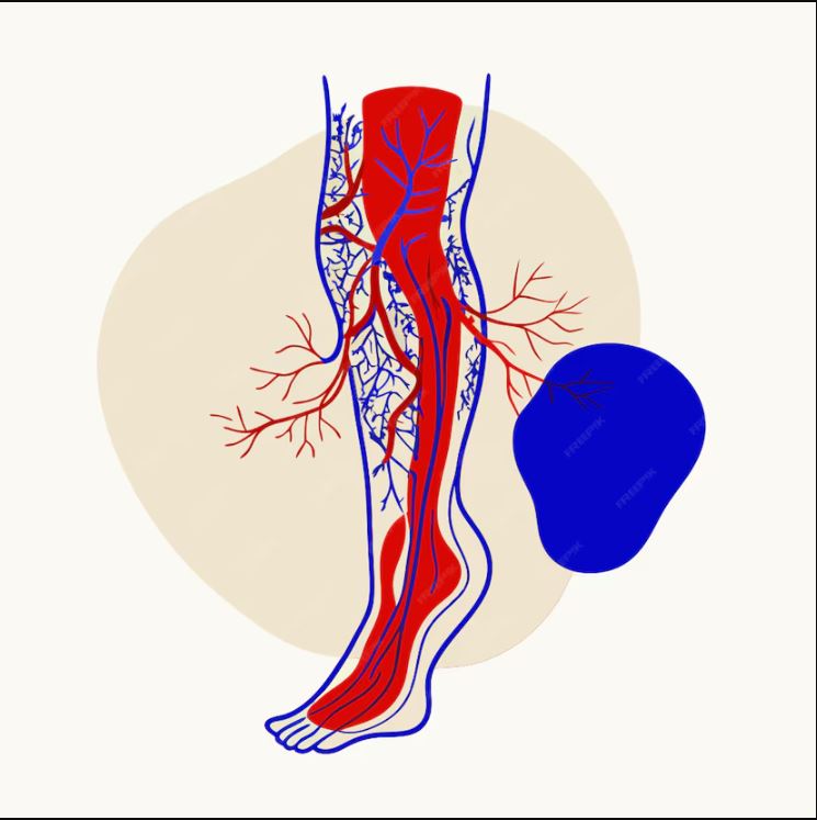 پیشگیری از واریس