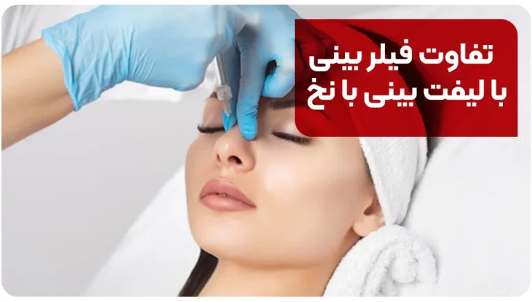 تفاوت فیلر بینی با لیفت بینی با نخ