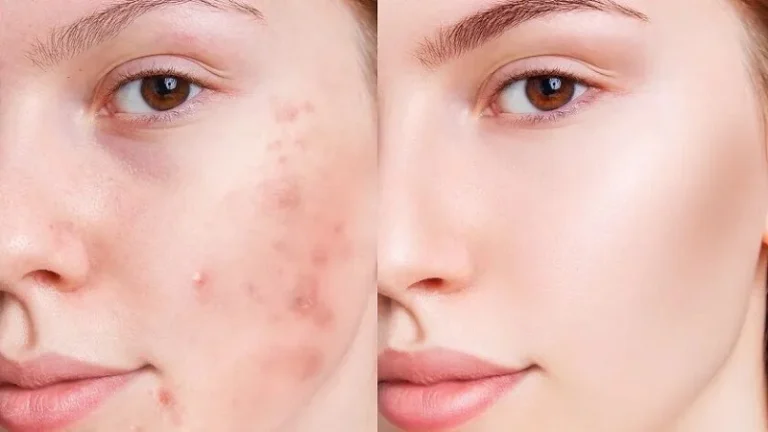 کرم ترمیم کننده صورت برای پوست های آسیب دیده